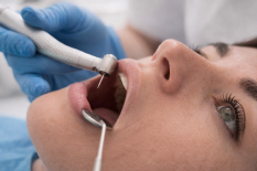 Пломбирование зубов