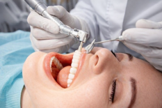 Ультразвуковая чистка зубов