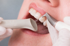 Чистка зубов Air flow