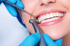 Профессиональная гигиена рта