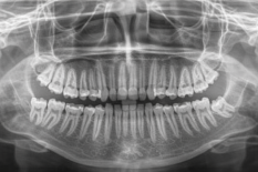 Ортопантомограмма
